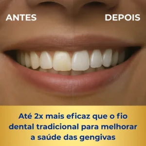 O irrigador dental jetfloss mais eficiente que o fio dental