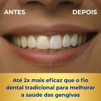 O irrigador dental jetfloss mais eficiente que o fio dental