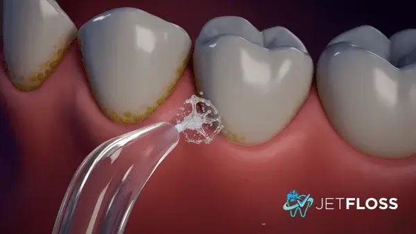 Como usar o irrigador oral jetfloss