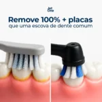 Escova de Dente Elétrica JET ONE [LANÇAMENTO JETFLOSS] - Imagem 9